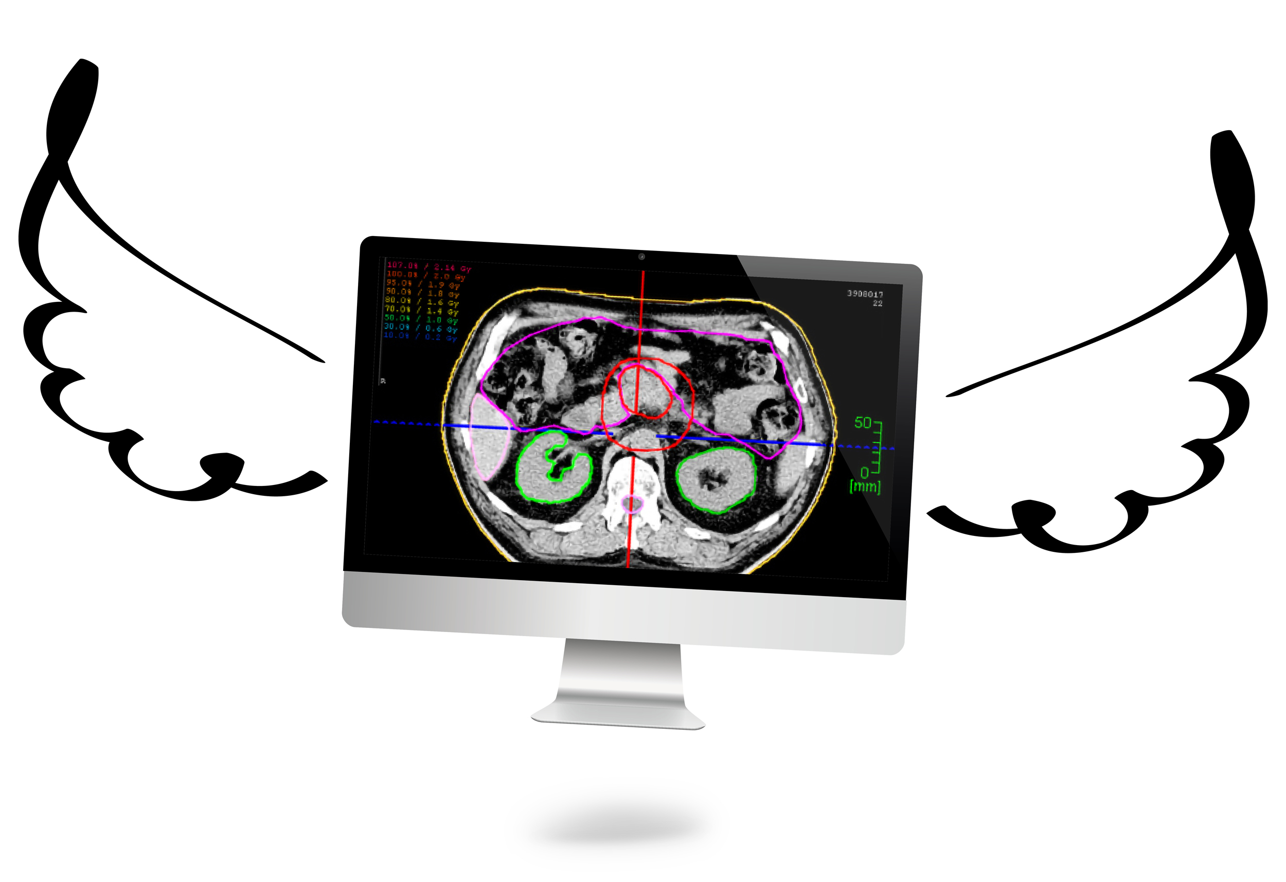 CHILI Radiology RT-Viewer